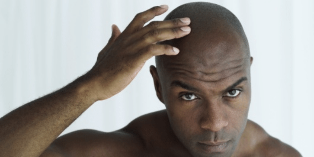 14 Things Every Guy Struggling To Grow His Hair Can Relate To | Zikoko!