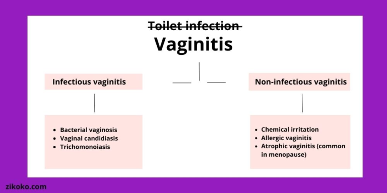 Talk True: Are Toilet Infections Actually a Thing? | Zikoko!